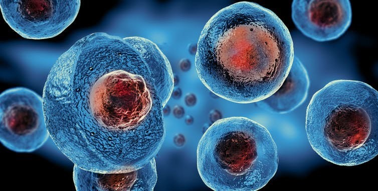 Ghép tế bào gốc điều trị bệnh phổi tắc nghẽn mạn tính